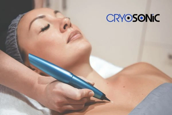 Cryosonic lesion removal prices book today! Royal Leamington Spa