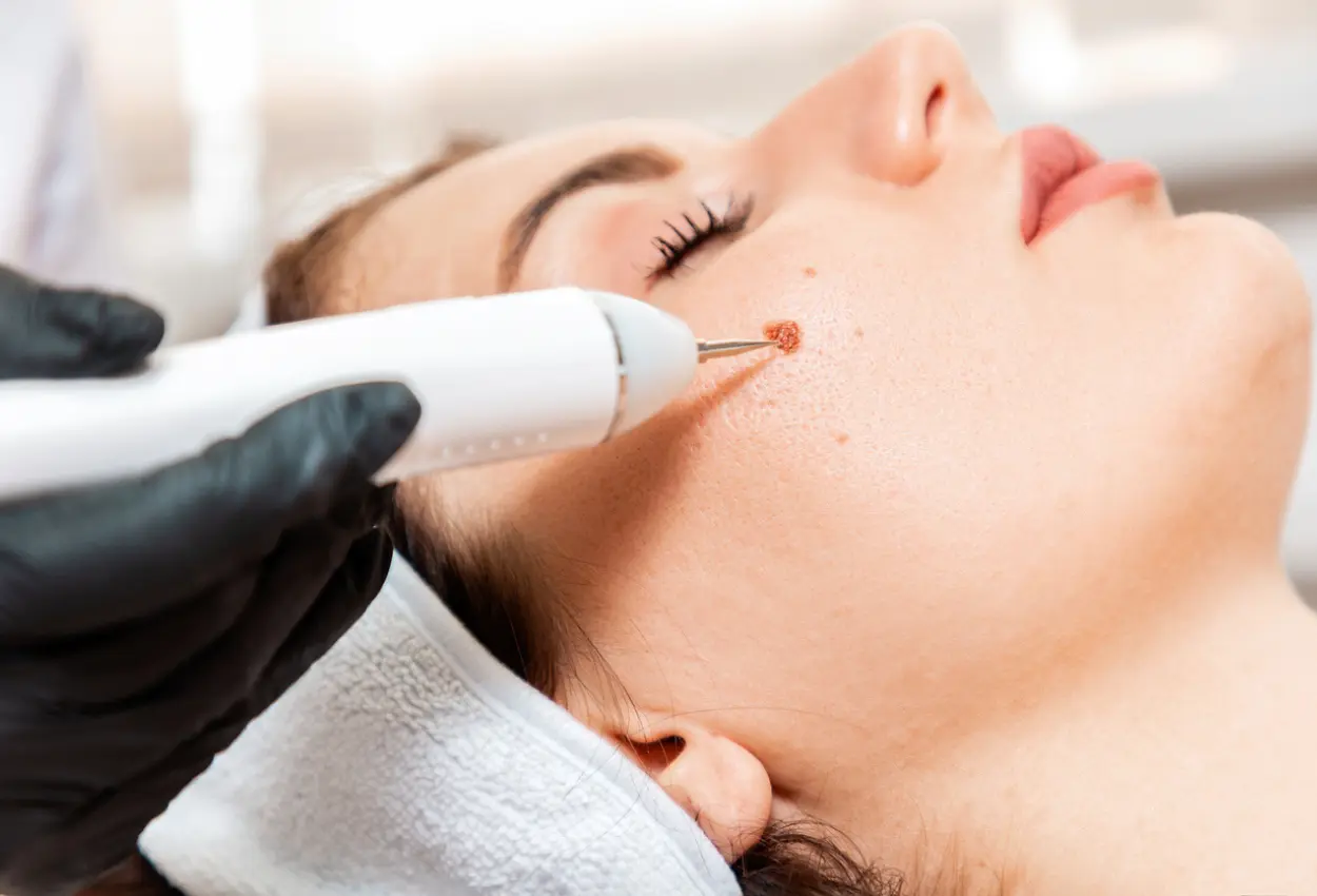 Frequently Asked Questions About Multiple Cryotherapy Treatments Royal Leamington Spa