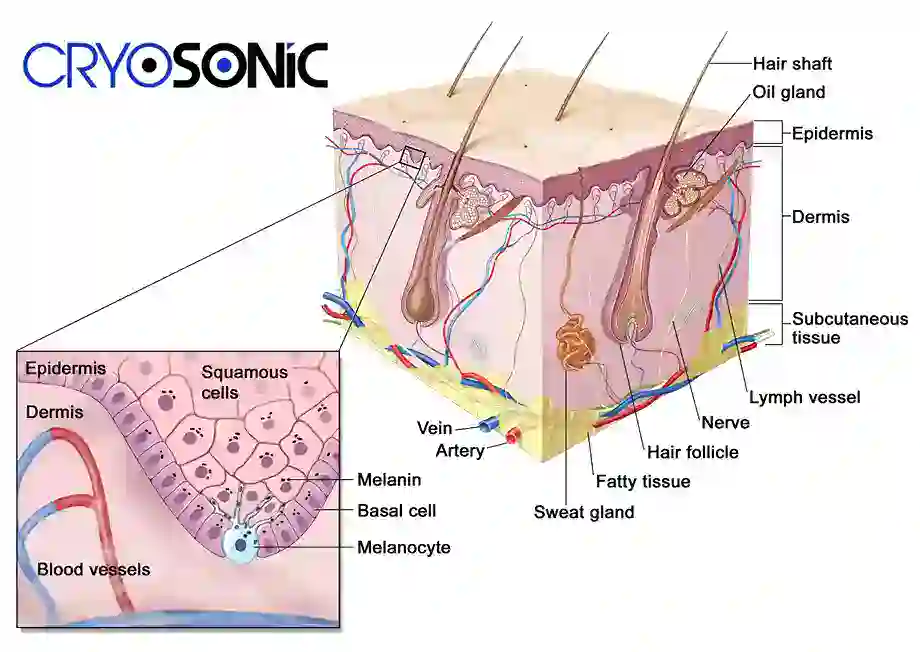 How Cryotherapy Stimulates Melanocyte Activity  Royal Leamington Spa